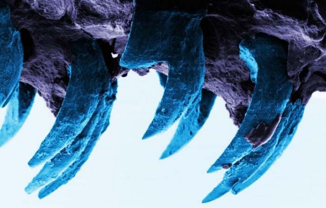 The teeth of the limpet