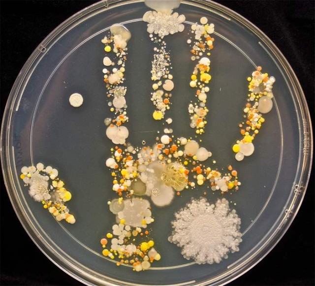 Bacteria on the Handprint of an 8-year-old
