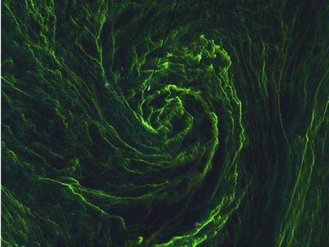 Eye of an Algal Storm 