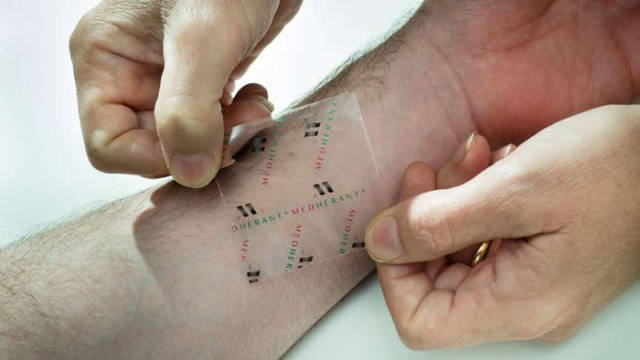 Ibuprofen patch delivers pain relief where it's needed 