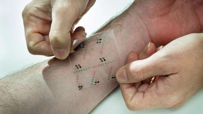 Ibuprofen patch delivers pain relief where it's needed