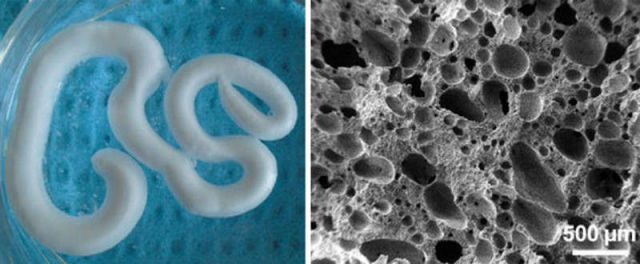 Injectable Foam repairs Degenerating Bones 