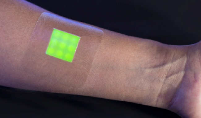 Smart Bandage Signals Infection