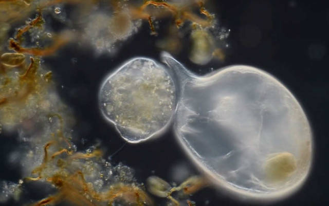 A Trachelius ciliate feeding on a Campanella ciliate 