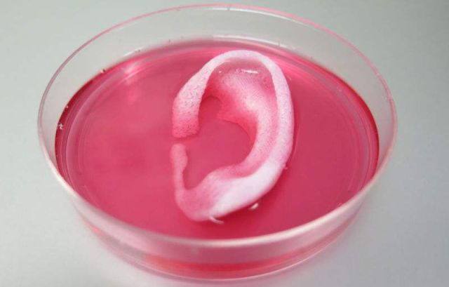 3D Printing a Transplantable Human Ear 