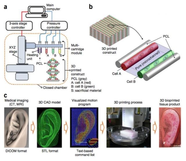 3D Printing a Transplantable Human Ear 