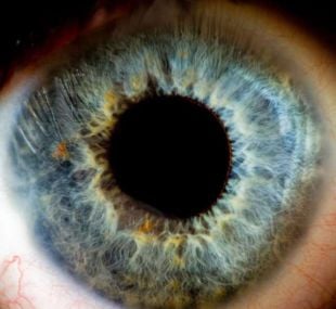 Doctors aim to Restore Sight to the Blind | WordlessTech