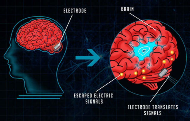 The Evolution of Brain-Computer Interfaces