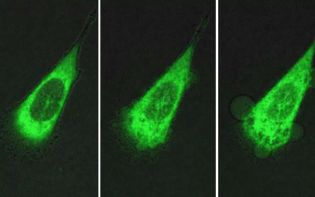 Motorised molecules can kill Cancer Cells