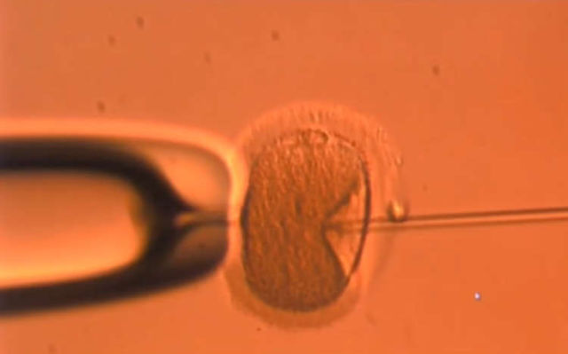 The longest-frozen Embryo to be born
