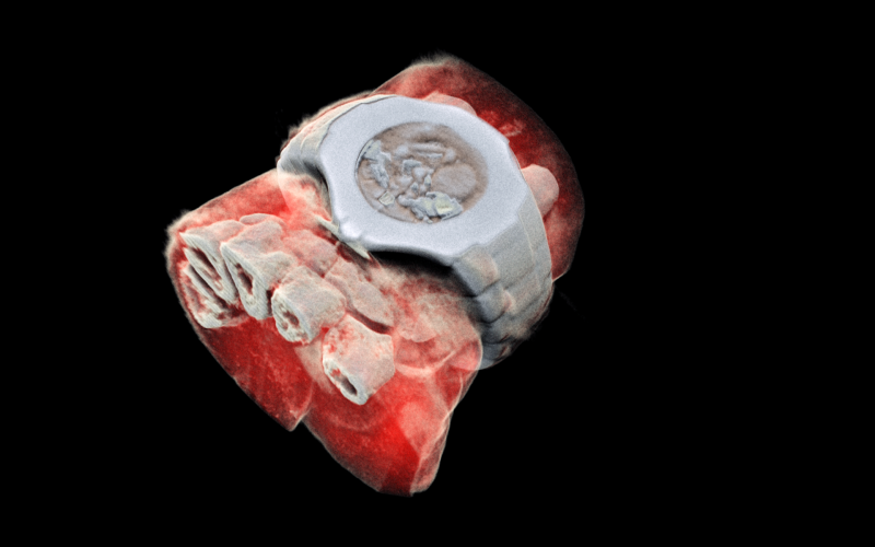 First 3D color X-ray of a Human