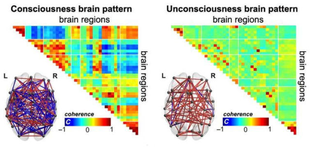 Scientists identified Brain patterns of Consciousness 