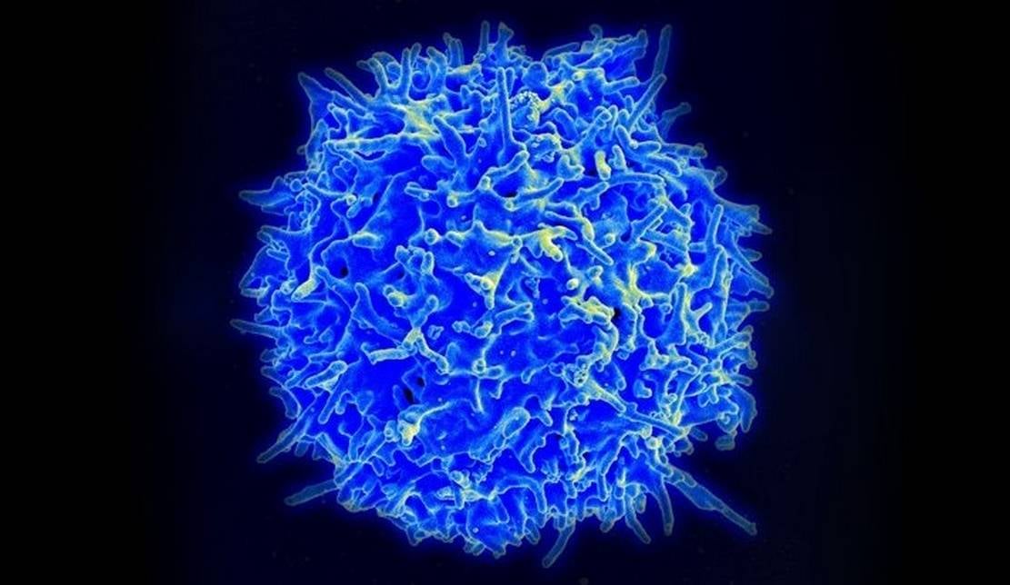 T-cell that Kills most Cancers