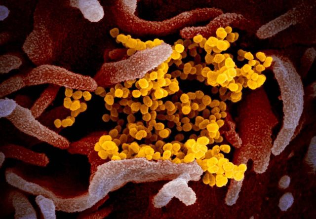 Coronavirus electron microscope image