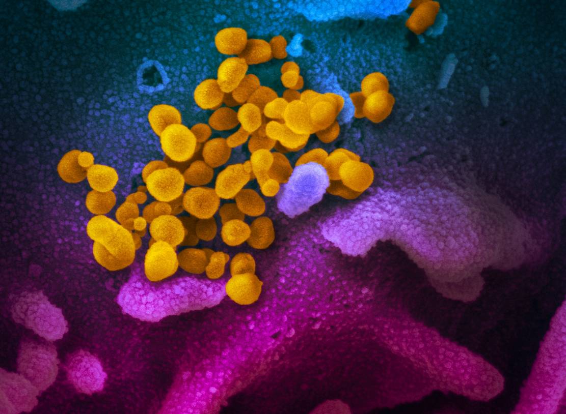 Coronavirus electron microscope image (4)
