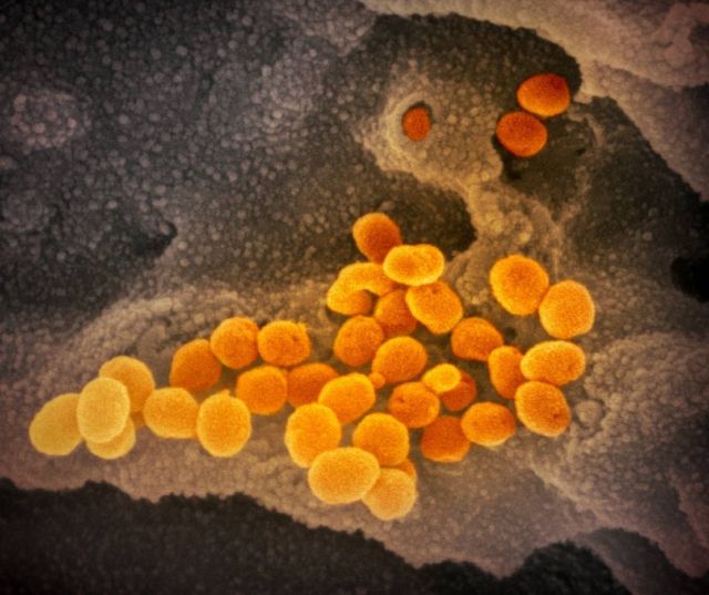 Coronavirus electron microscope image (2)