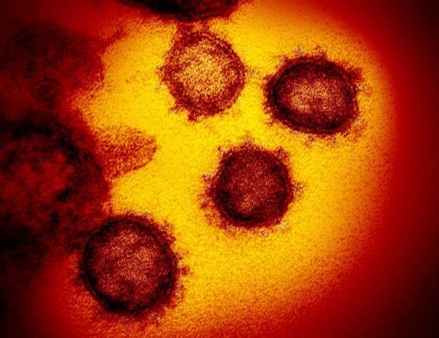 Coronavirus electron microscope image (1)
