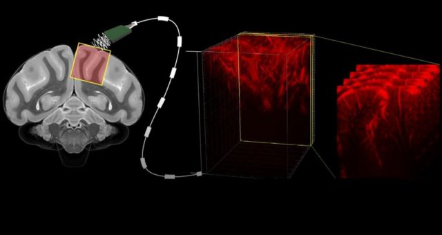 Reading Minds with Ultrasound