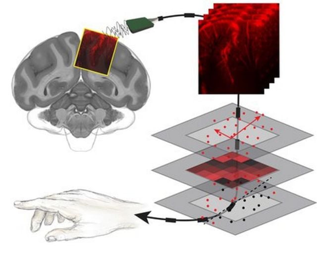 Reading Minds with Ultrasound