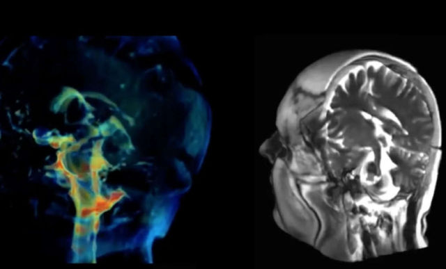 New Imaging technique captures how Brain moves