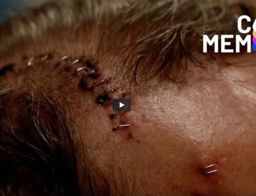 Mr. Smith Gets a Neuralink Brain Implant