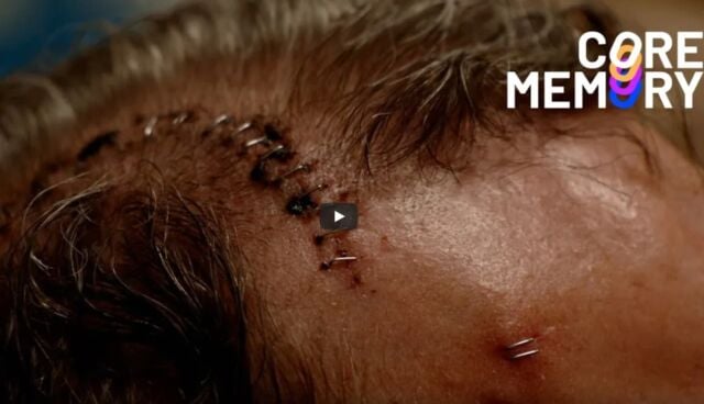 Mr. Smith Gets a Neuralink Brain Implant 1