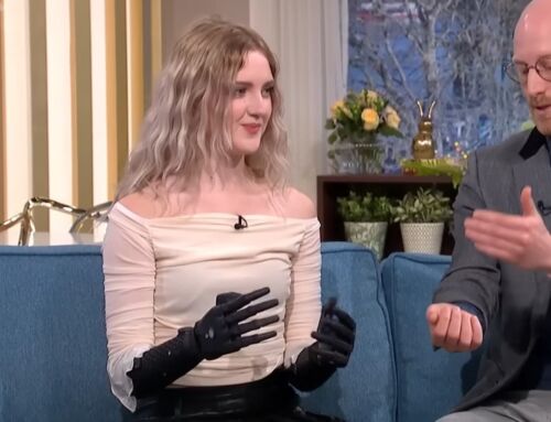 World’s Most Advanced Bionic Hands