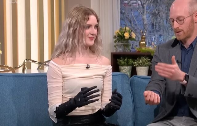 World’s Most Advanced Bionic Hands
