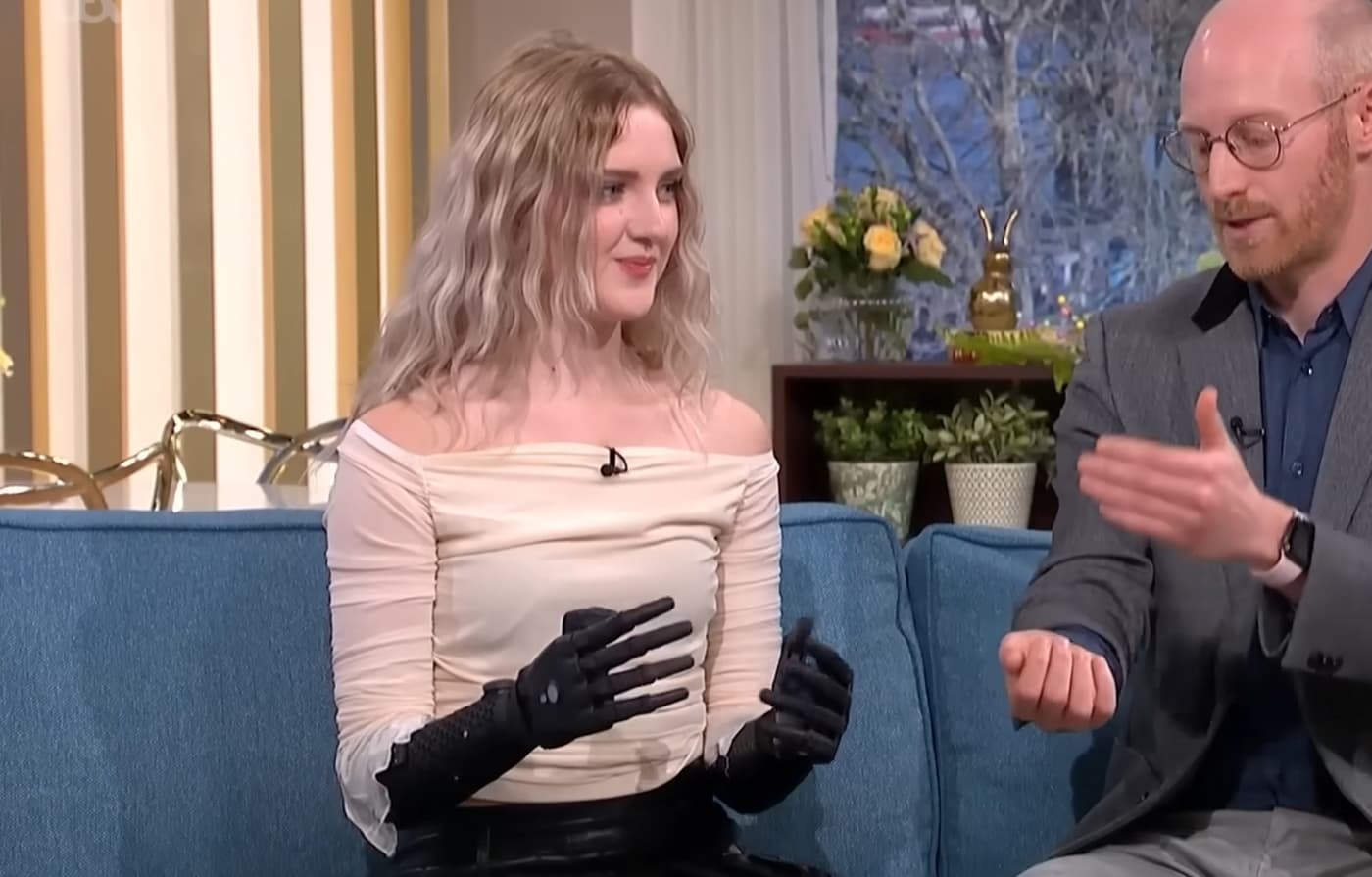 World’s Most Advanced Bionic Hands