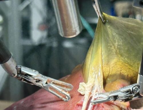 A robot Perfectly Performs Surgeries