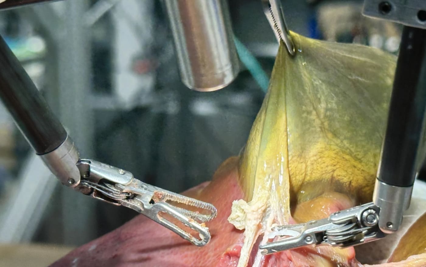 A robot Perfectly Performs Surgeries